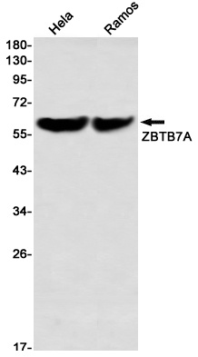 ZBTB7A Rabbit mAb