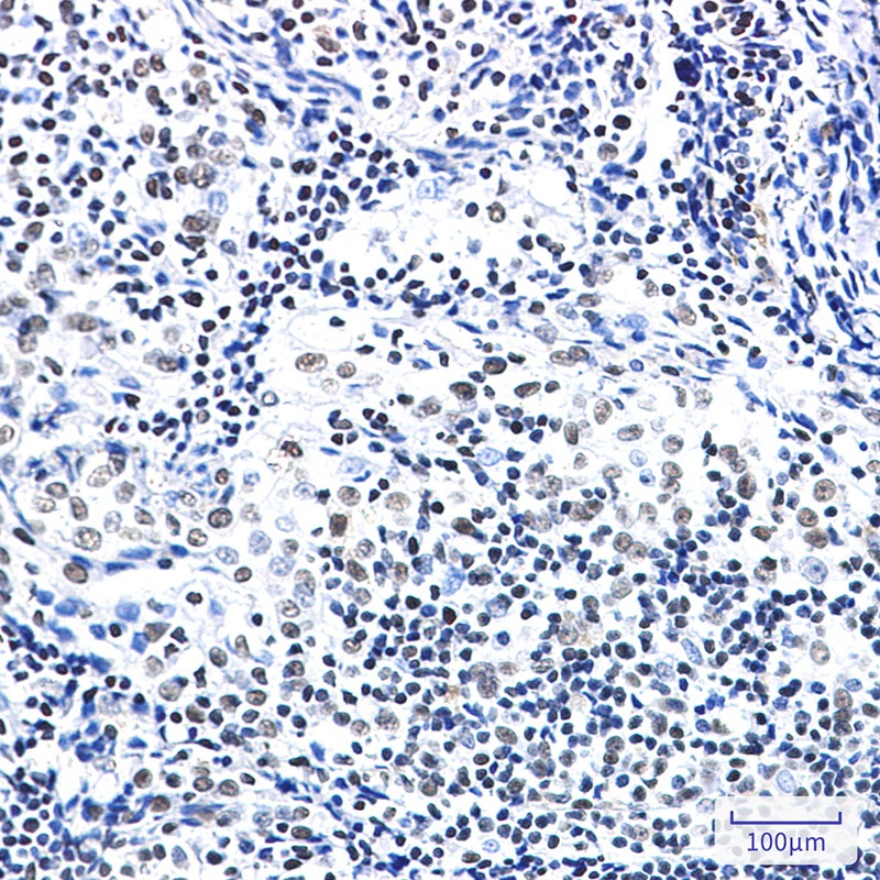 ZBTB7A Rabbit mAb
