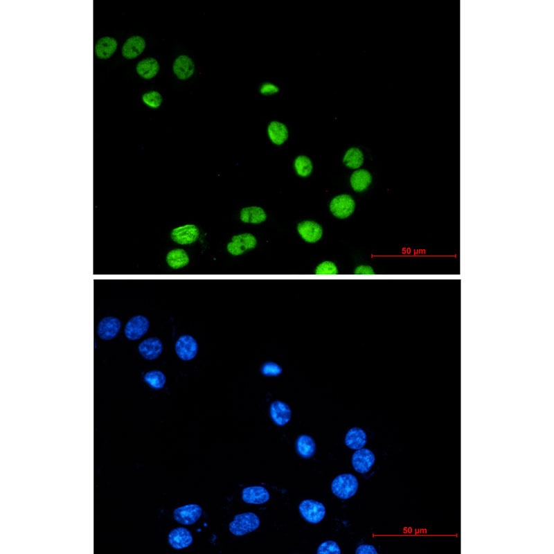 ZBTB7A Rabbit mAb