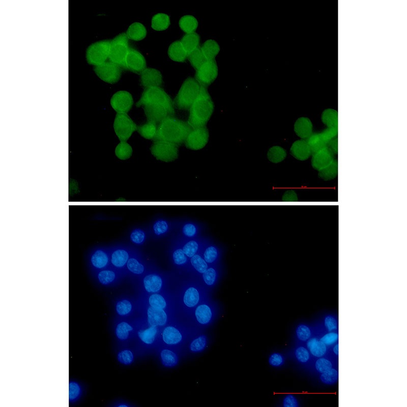Ubiquitin K63 Rabbit mAb
