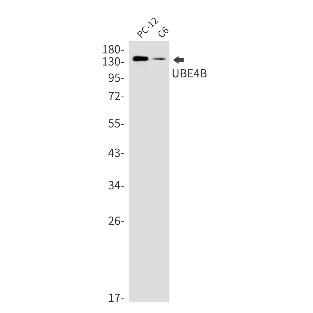 Ubiquitin Conjugation Factor E4 B Rabbit mAb