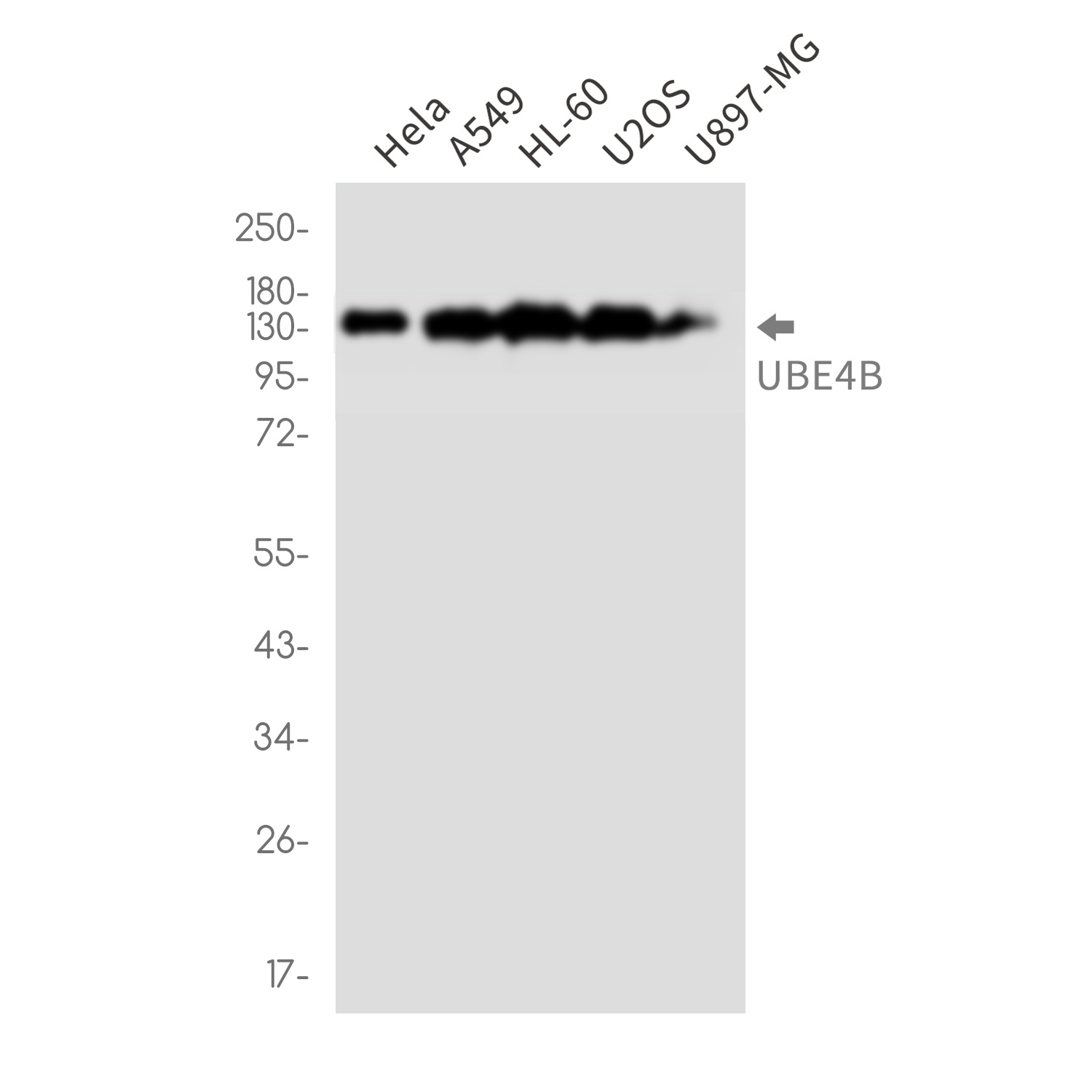 Ubiquitin Conjugation Factor E4 B Rabbit mAb