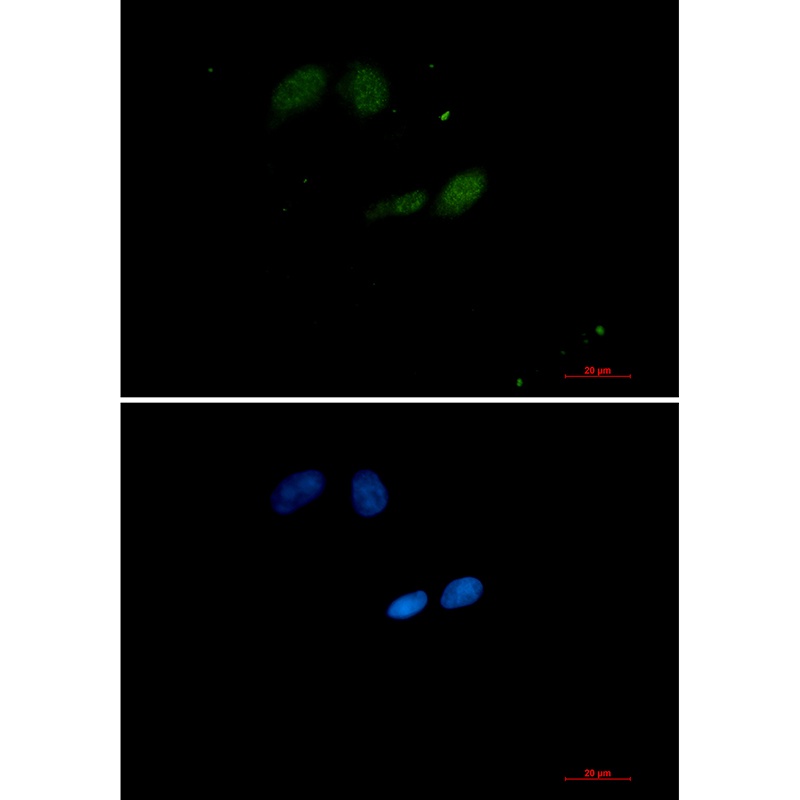 UBE2I Antibody