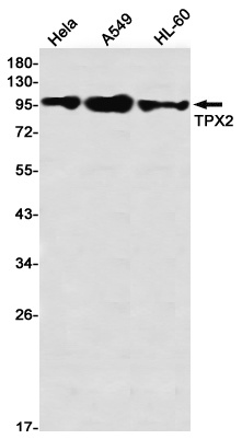 TPX2 Rabbit mAb