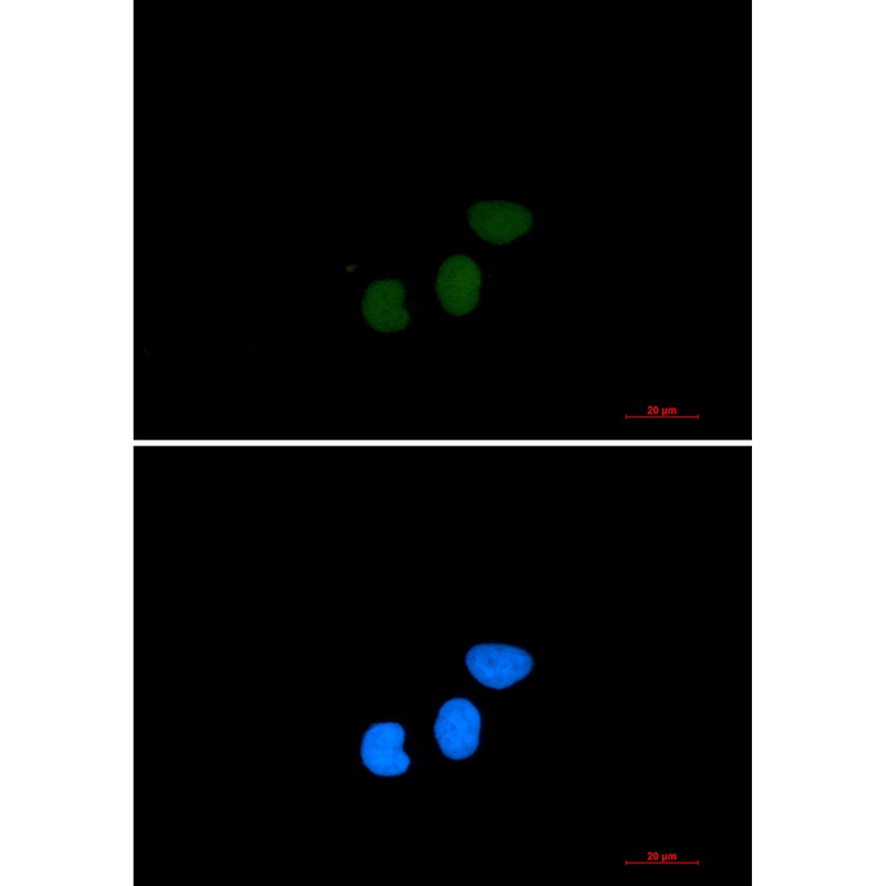 TPX2 Rabbit mAb