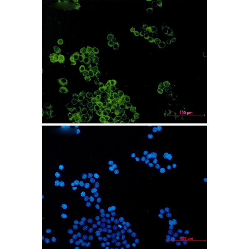 Dynein Light Chain Tctex Type 1 Rabbit mAb
