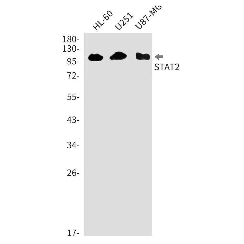 STAT2 Rabbit mAb