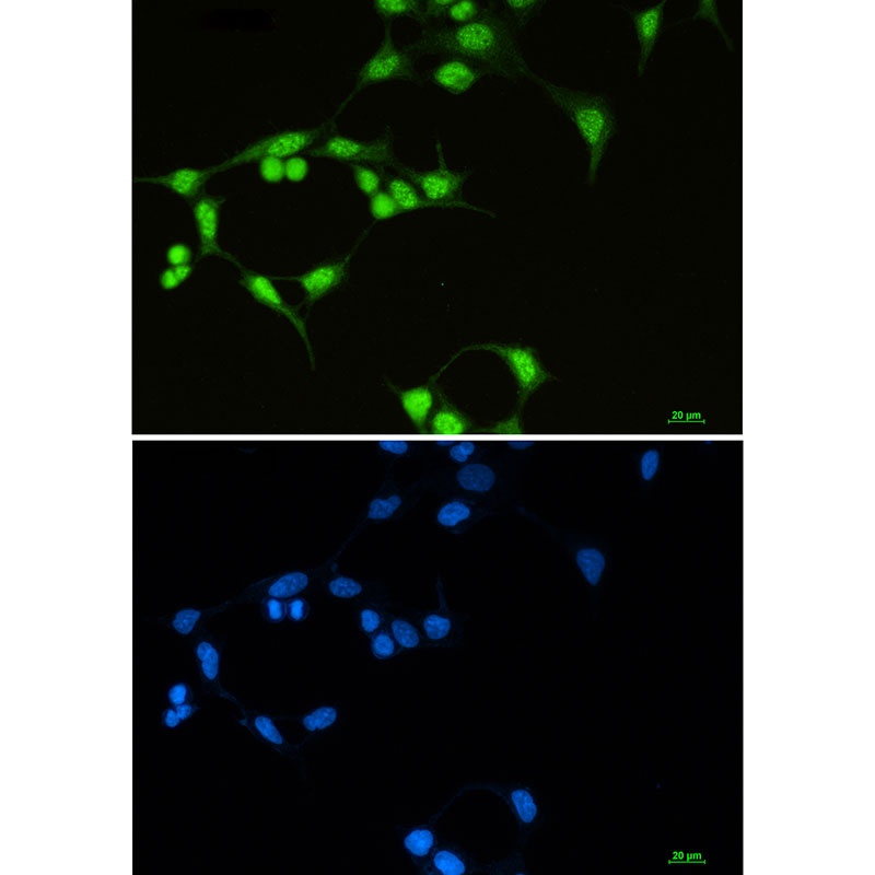 SF3B1 Rabbit mAb