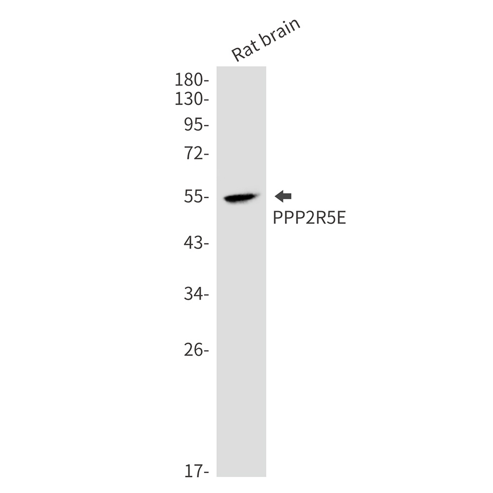 PPP2R5E Antibody