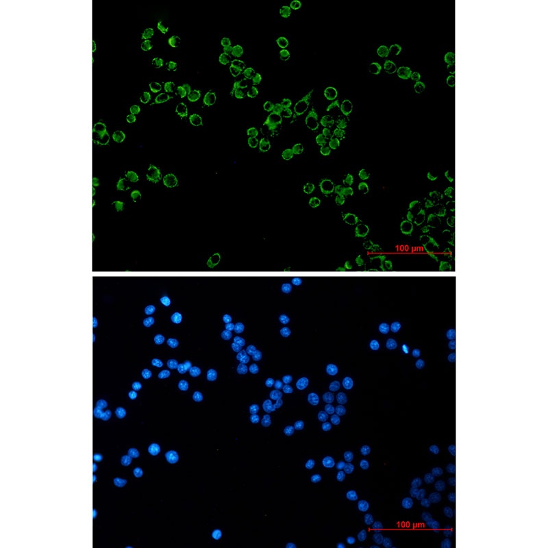 Peroxiredoxin 3 Rabbit mAb