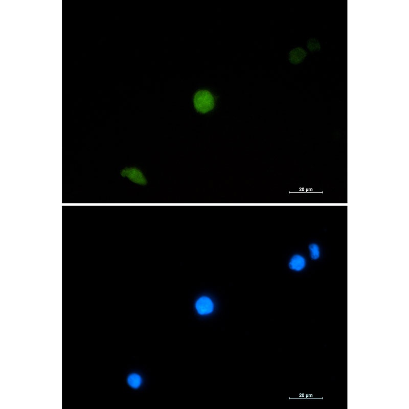 PELP1 Rabbit mAb