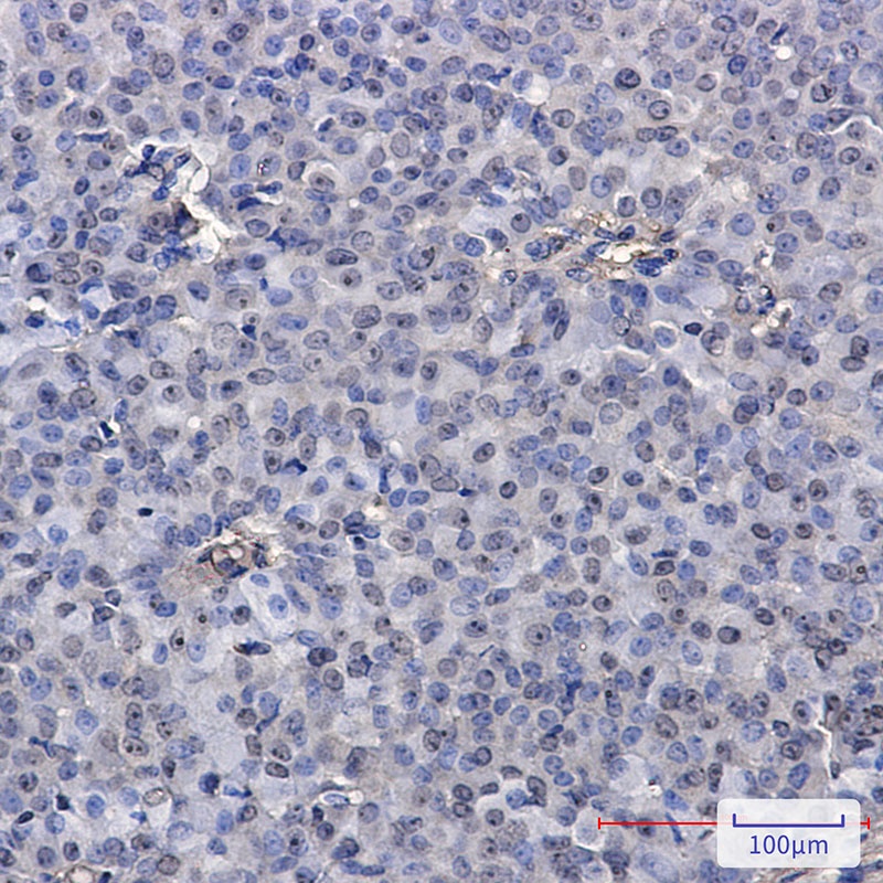 PELP1 Rabbit mAb