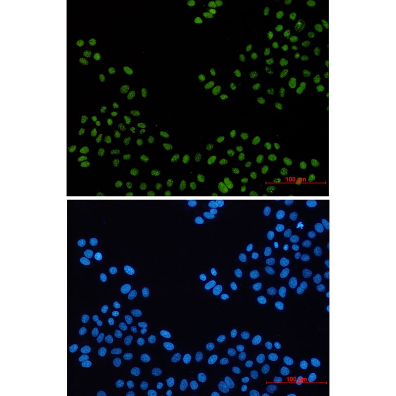PELP1 Rabbit mAb
