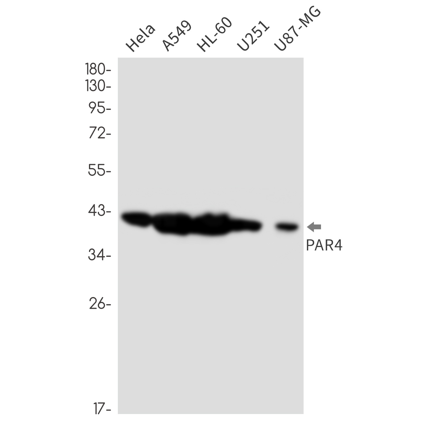 [KO] PAR4 Rabbit mAb