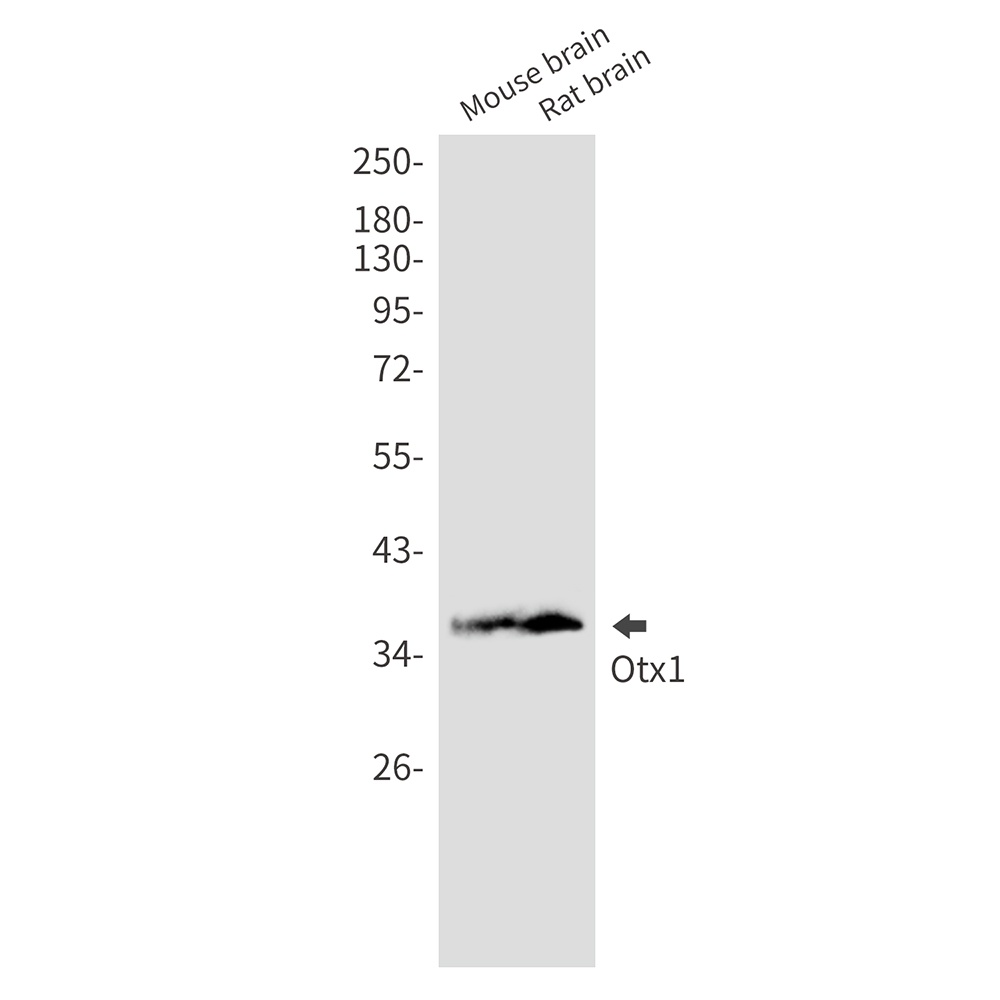 OTX1 Rabbit mAb
