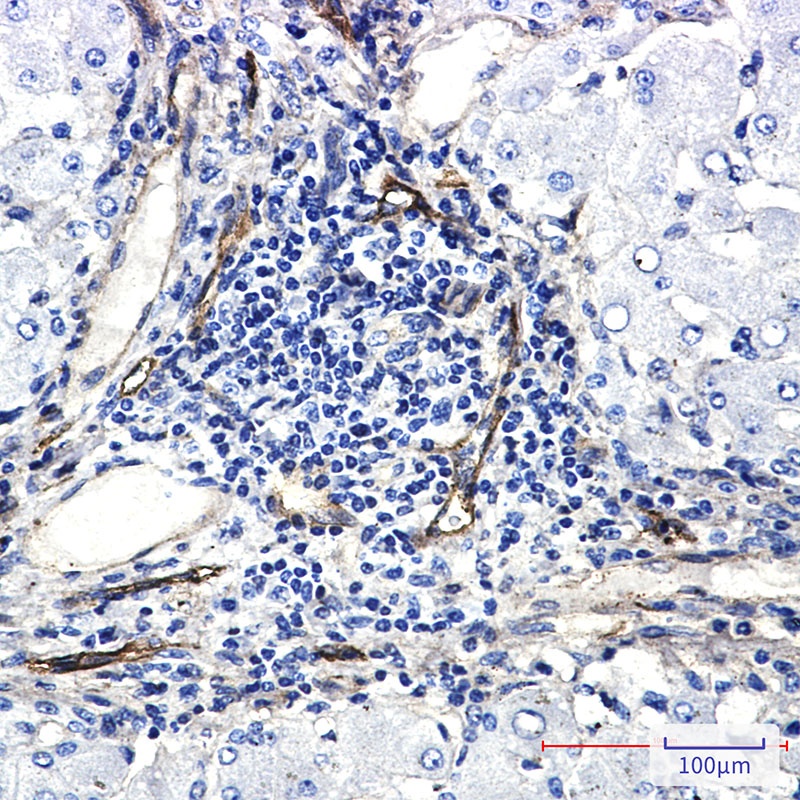 ORAI3 Rabbit mAb