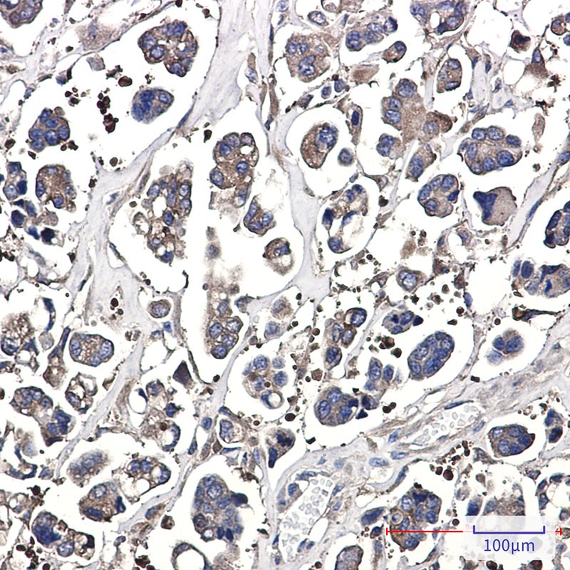 Optineurin Rabbit mAb