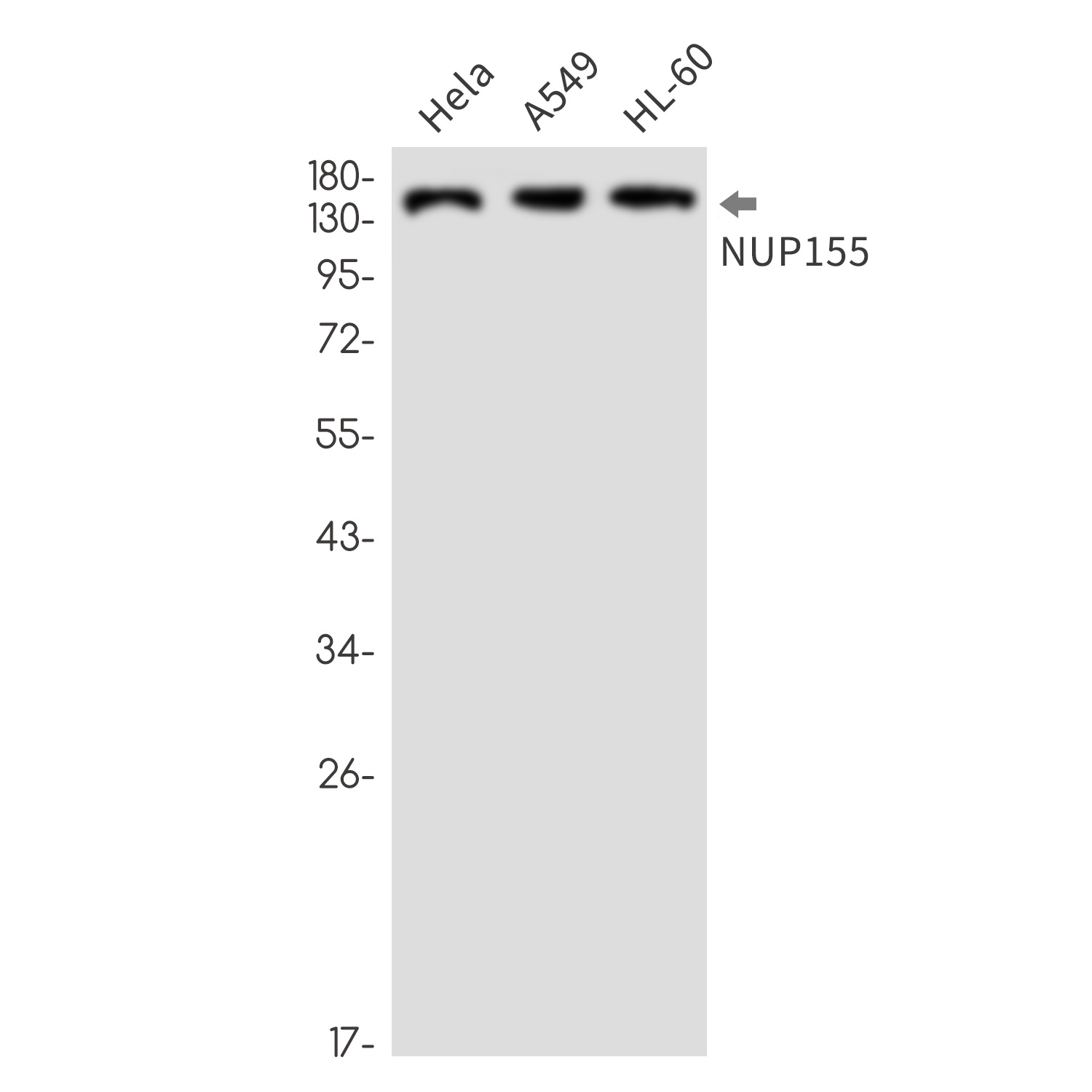 NUP155 Rabbit mAb
