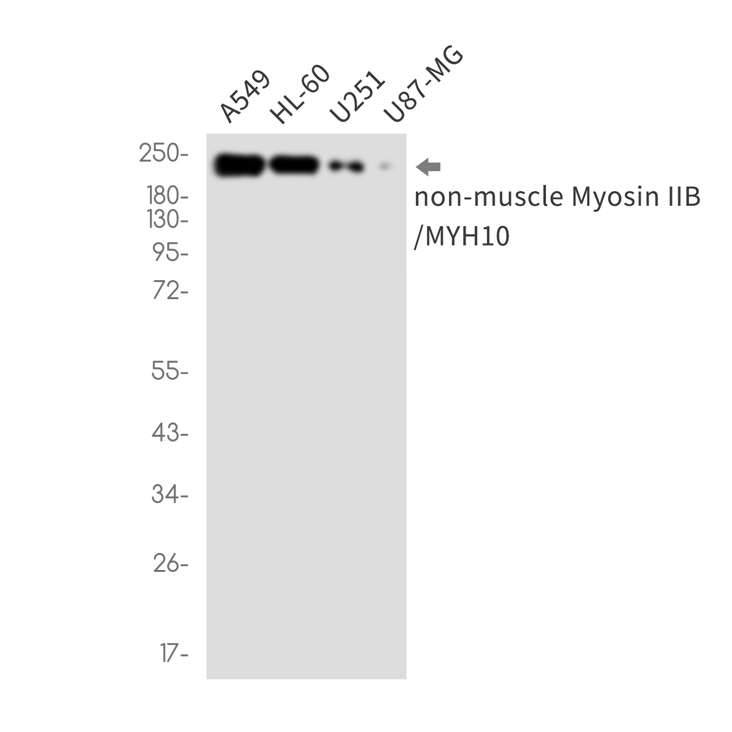 MYH10 Rabbit mAb