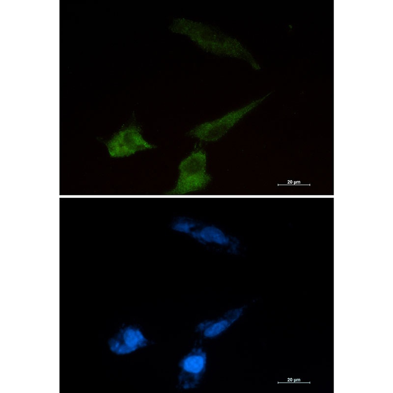 Niemann Pick C2 Rabbit mAb