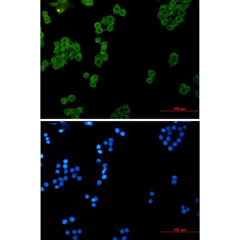 NDUFS1 Antibody