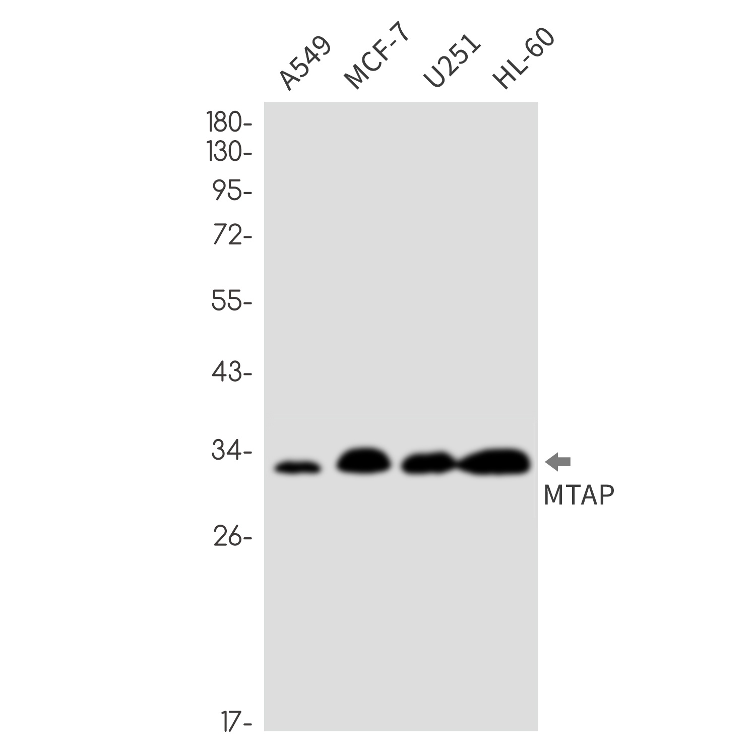 MTAP Rabbit mAb