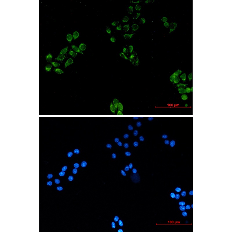 MRPS18B Rabbit mAb