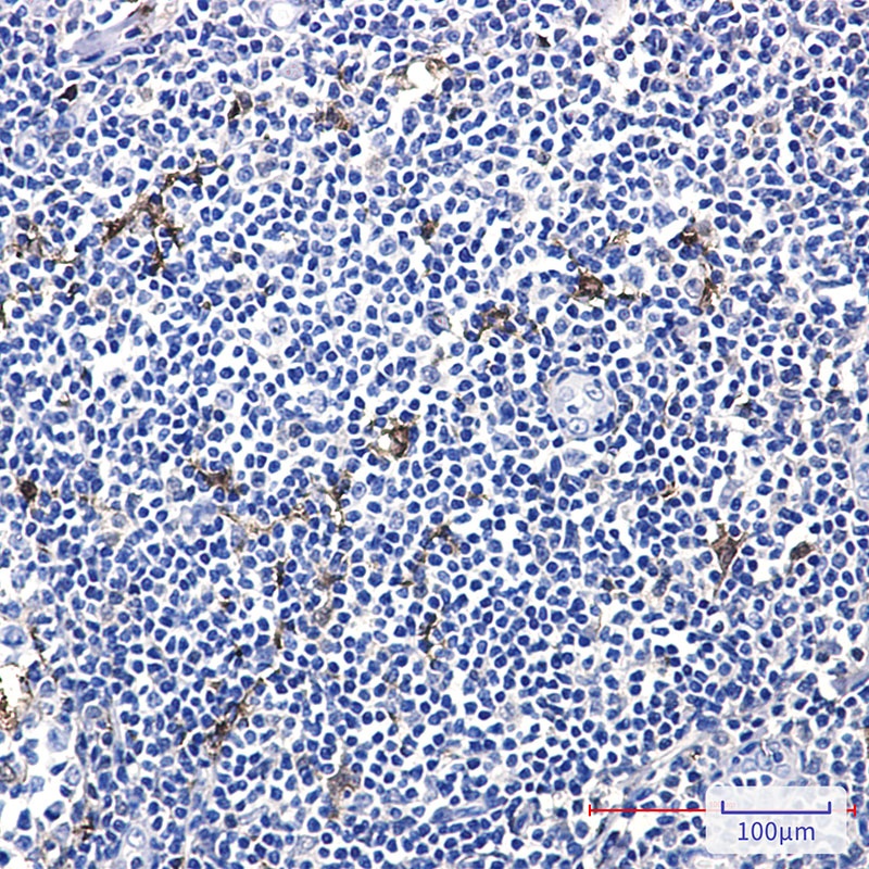 MERTK Rabbit mAb