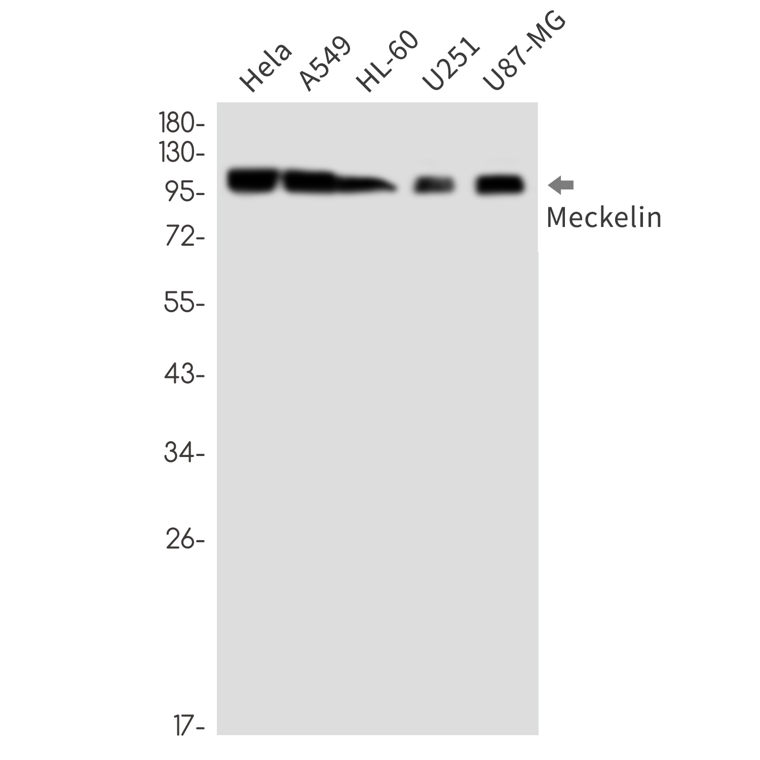 Meckelin Rabbit mAb