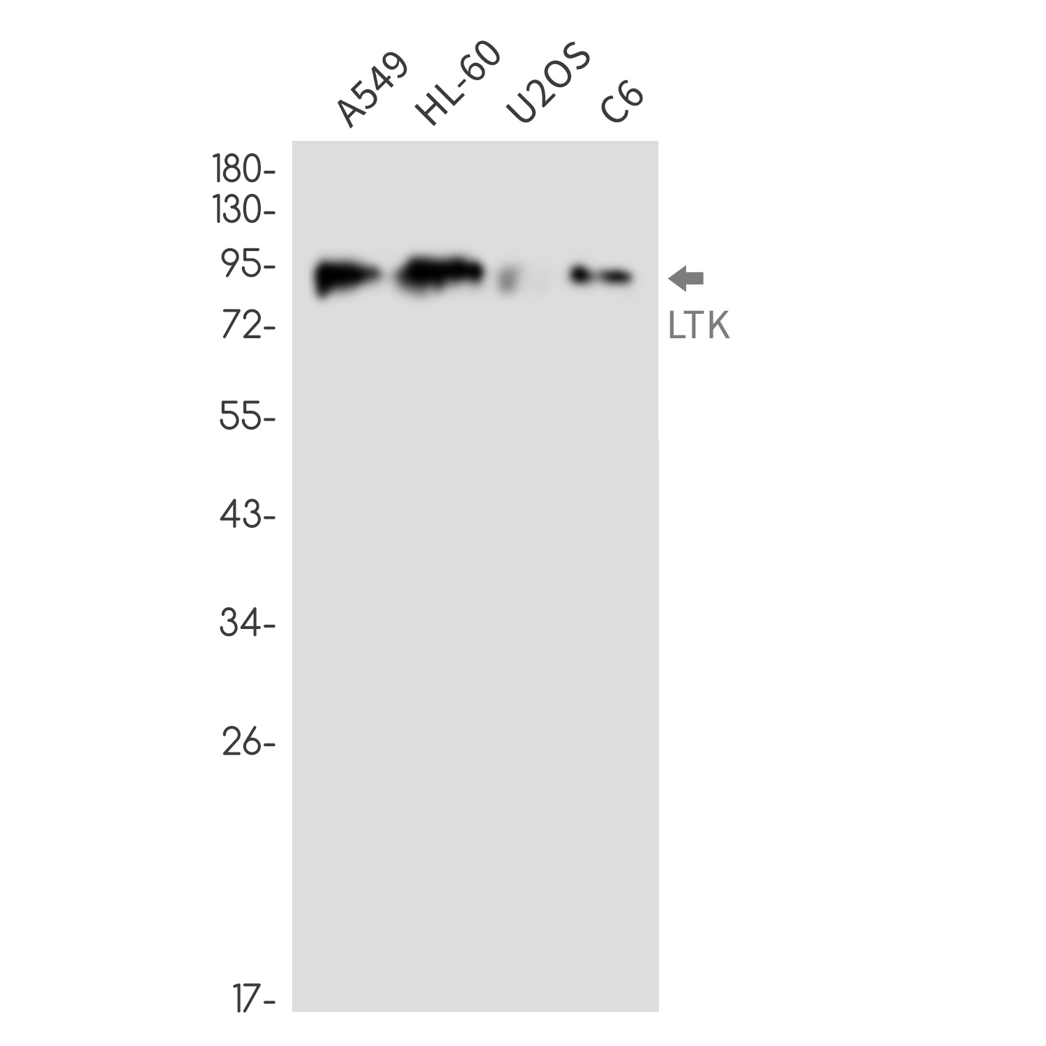 LTK Rabbit mAb
