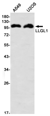 LLGL1 Rabbit mAb