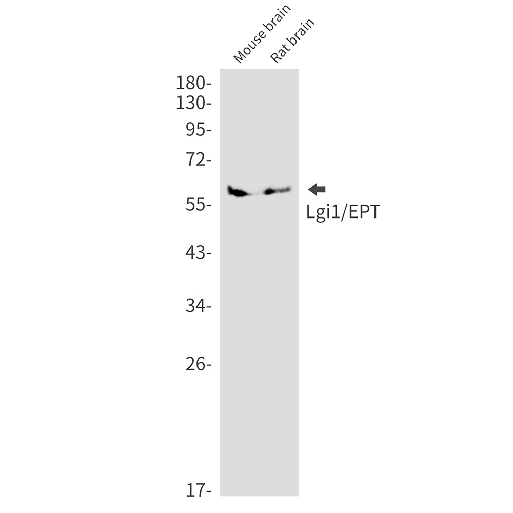LGI1 Rabbit mAb
