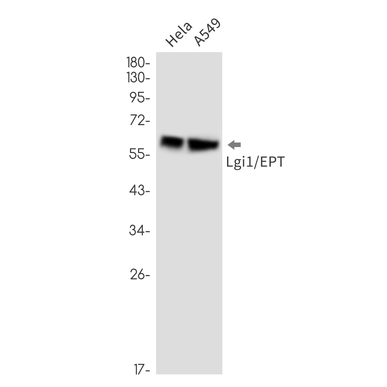 LGI1 Rabbit mAb