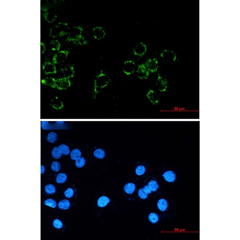 Junctional Adhesion Molecule 1 Rabbit mAb
