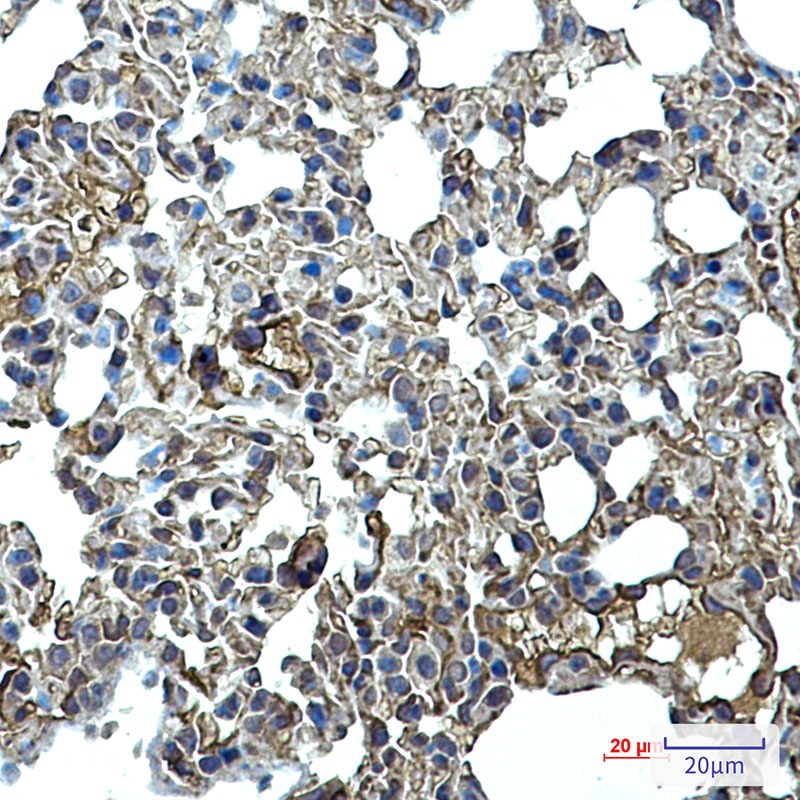 ICAM2 Rabbit mAb