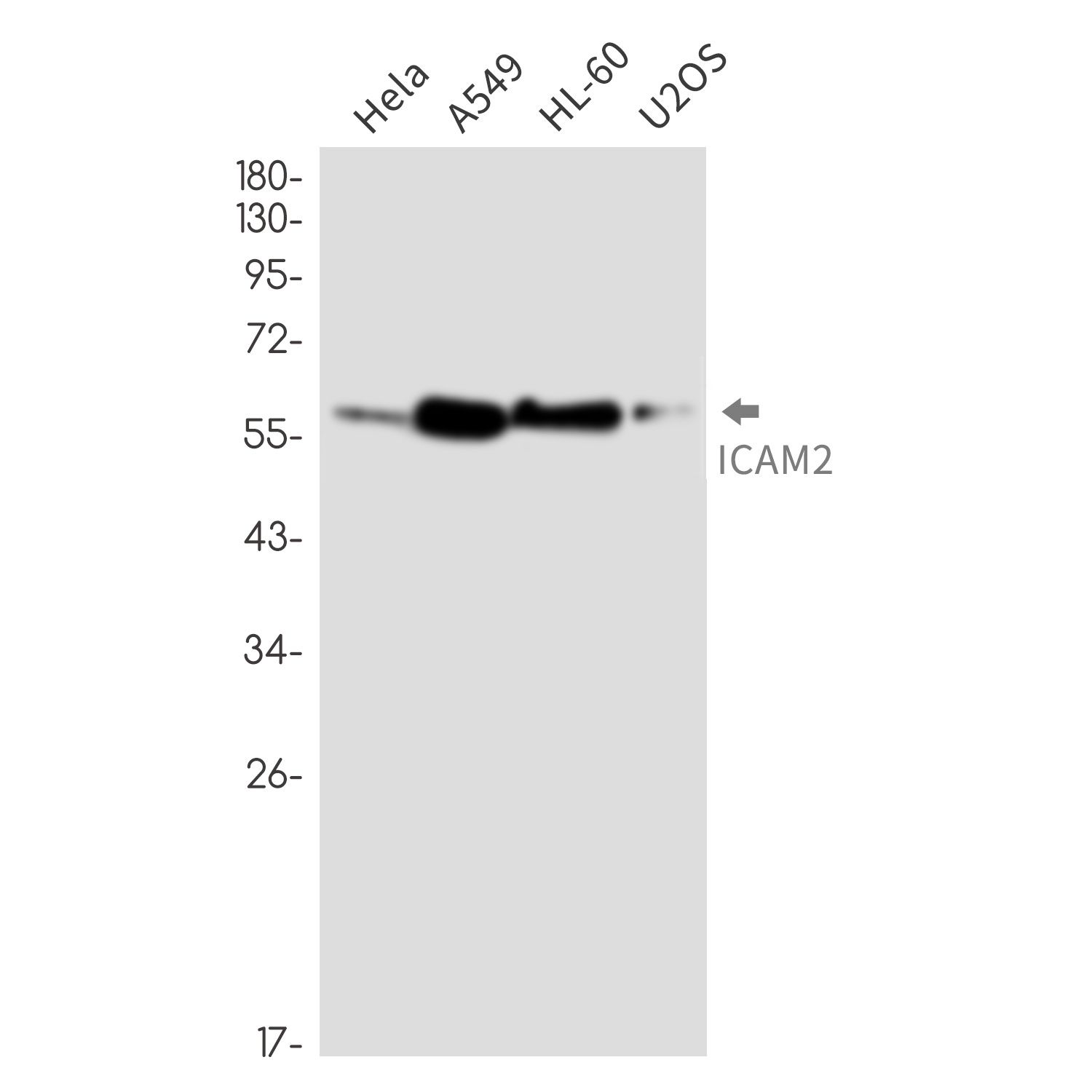 ICAM2 Rabbit mAb