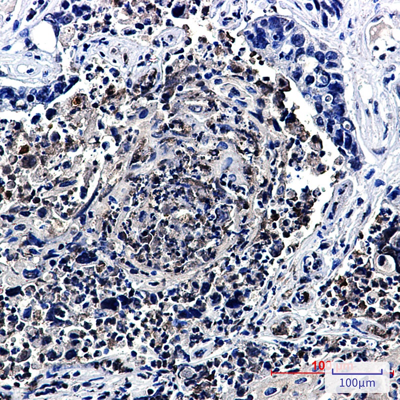 HJURP Rabbit mAb
