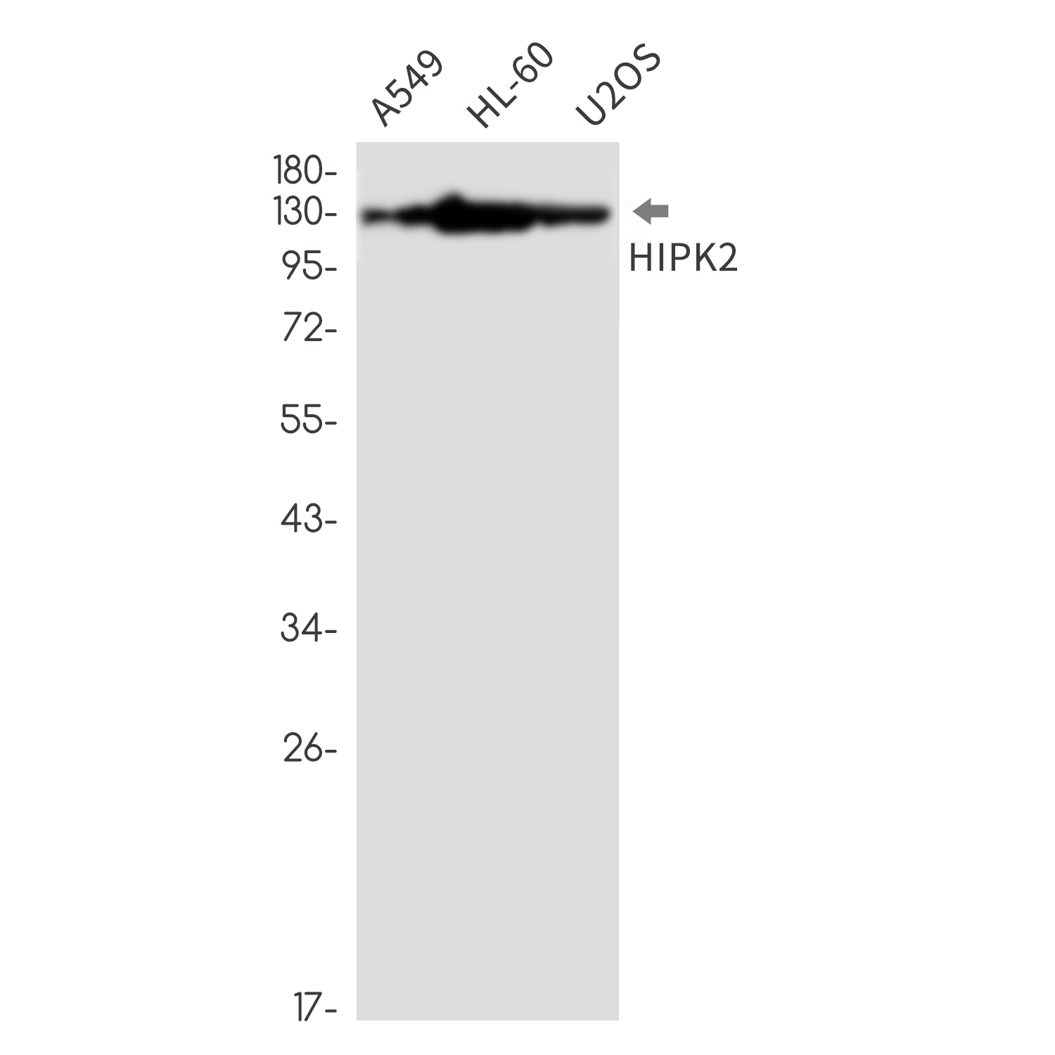HIPK2 Antibody