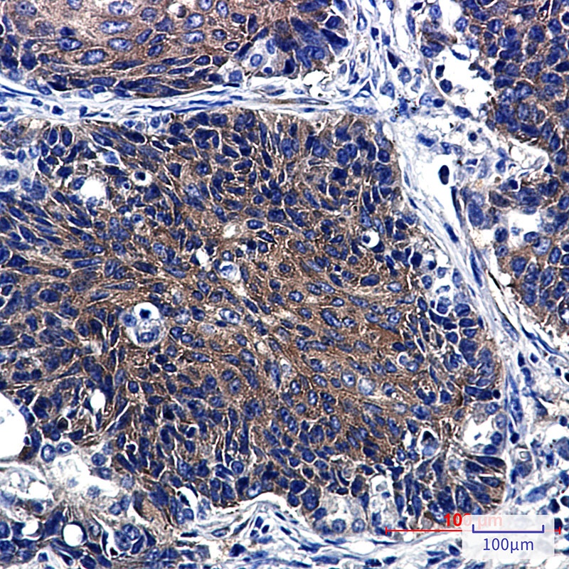 HIF Prolyl Hydroxylases Rabbit mAb
