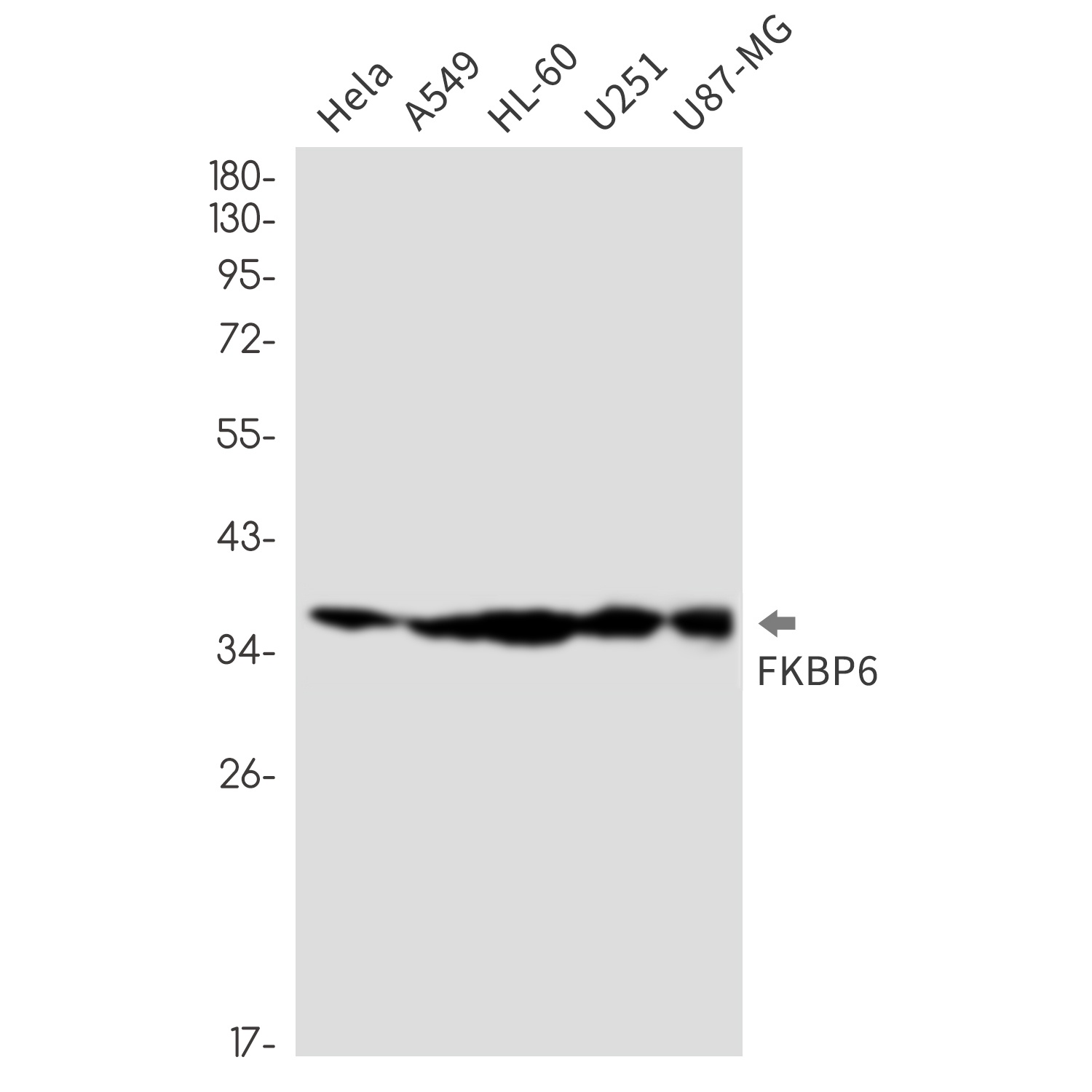 FKBP6 Rabbit mAb