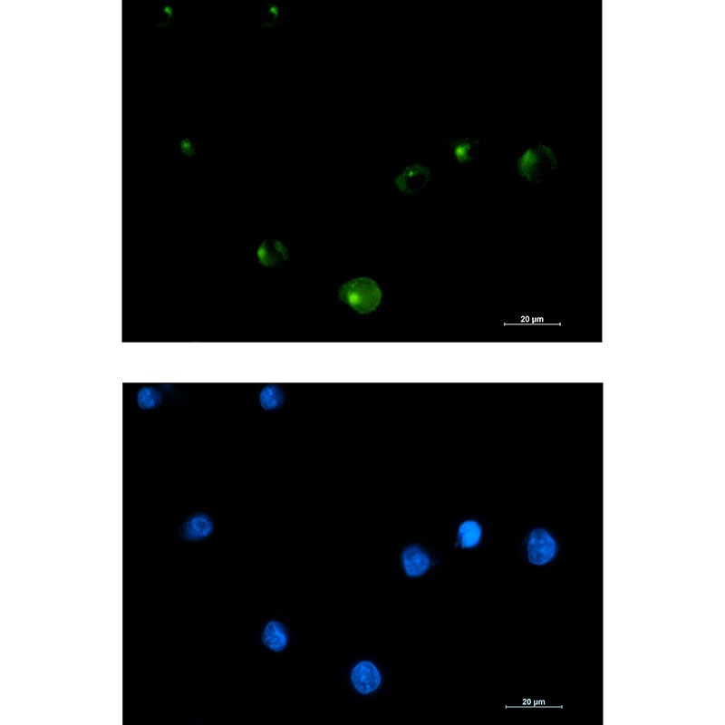 FGFR1 Oncogene Partner Rabbit mAb
