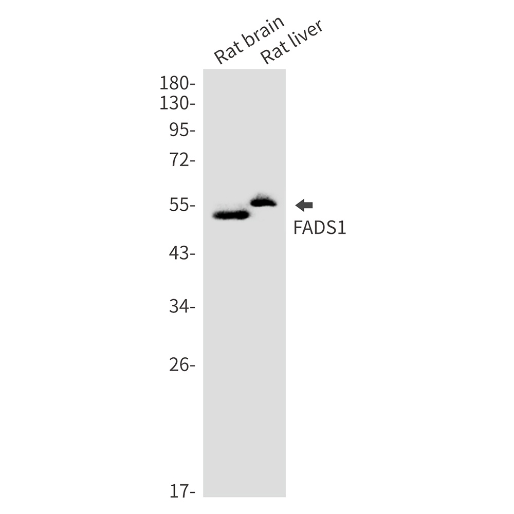 FADS1 Rabbit mAb