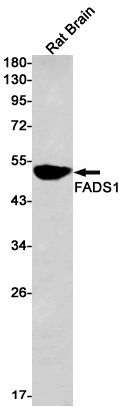 FADS1 Rabbit mAb