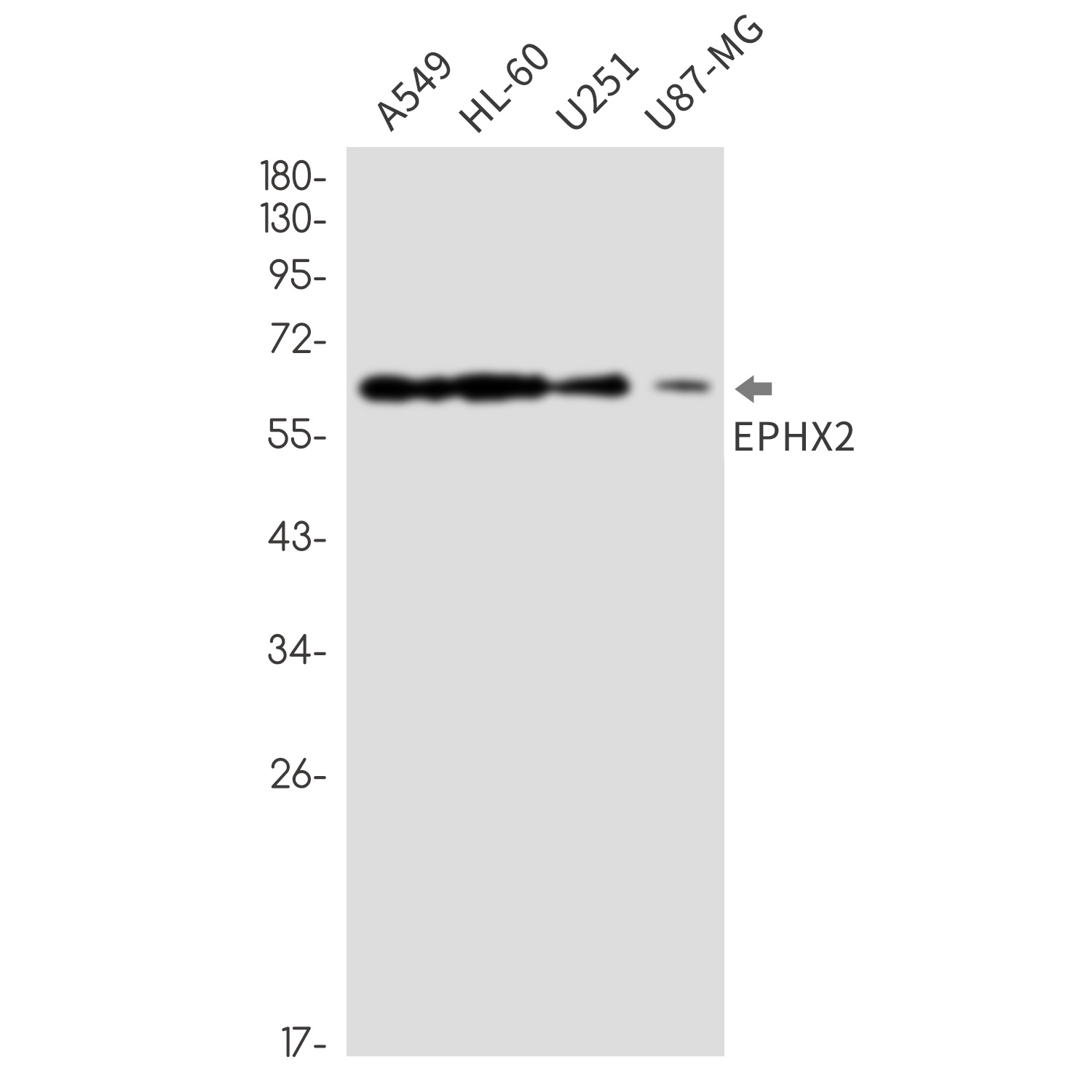 Epoxide Hydrolase 1 Rabbit mAb