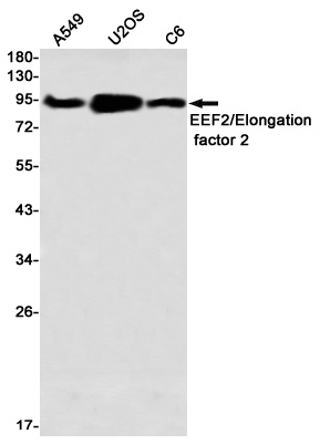 Elongation factor 2 Rabbit mAb