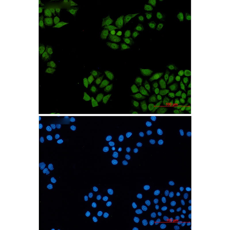 DDB1 Rabbit mAb