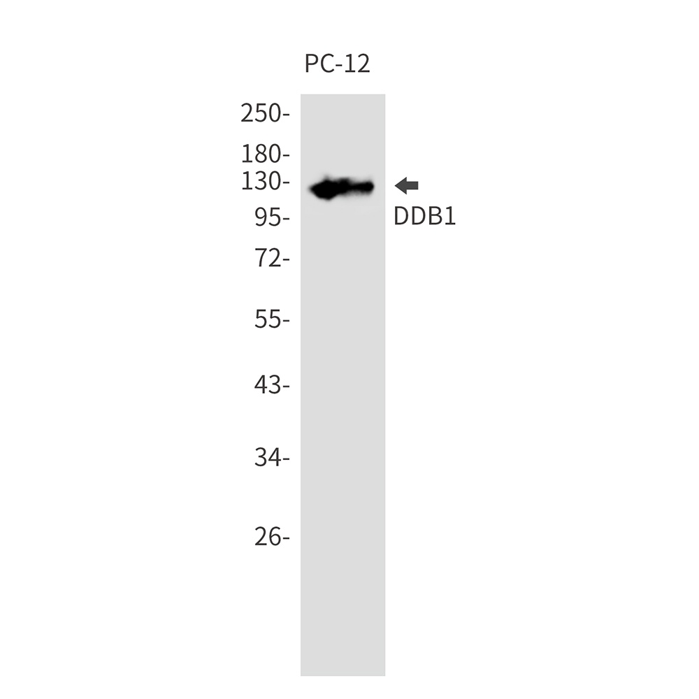 DDB1 Rabbit mAb