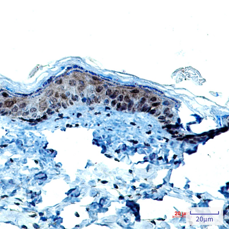 Cytokeratin 9 Rabbit mAb