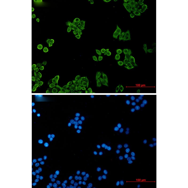 CSDE1 Rabbit mAb