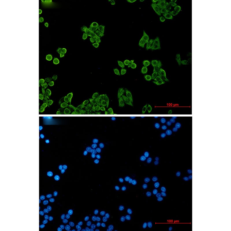 CSDE1 Antibody